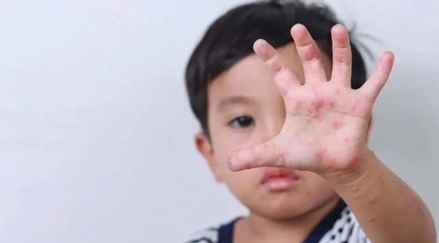 Chủ động phòng chống sốt rét - Giữ vững thành quả loại trừ