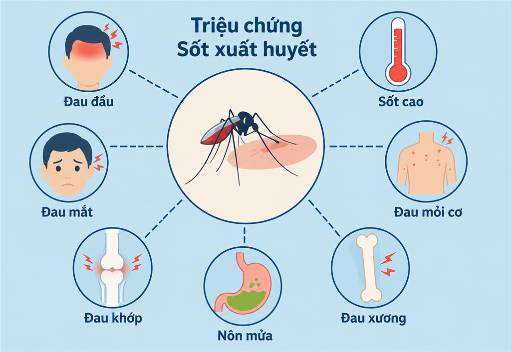 Sốt xuất huyết: Nhận biết các giai đoạn tiến triển để phòng ngừa biến chứng